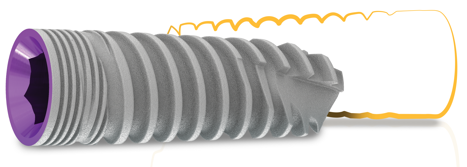 Enhanced SEVEN Implant